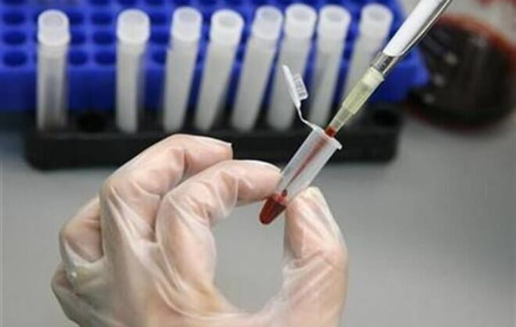 Breakthrough: IIT Roorkee Scientists Identify Molecule